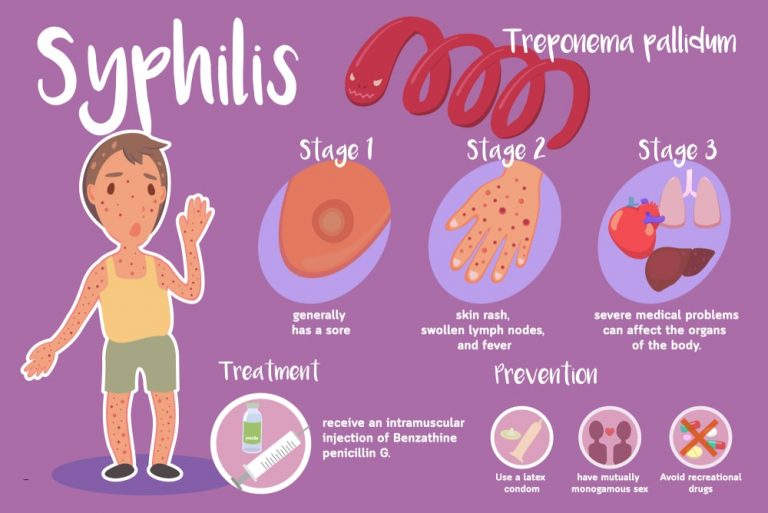 Syphilis Causes Treatment And More Solution Parmacy