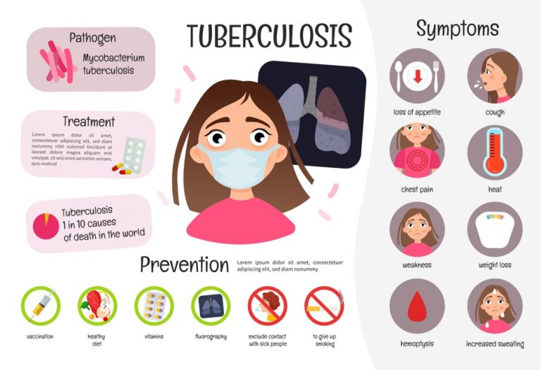 Tuberculosis (TB) Symptoms, Diagnosis, Treatment and More