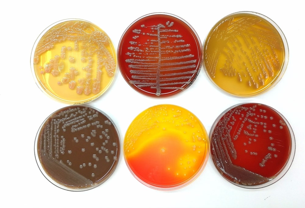 Culture Media In Microbiology