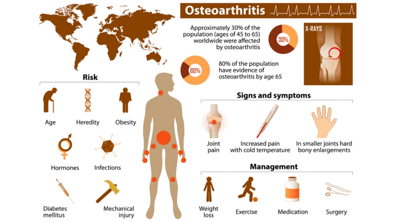 Nutraceuticals For Osteoarthritis