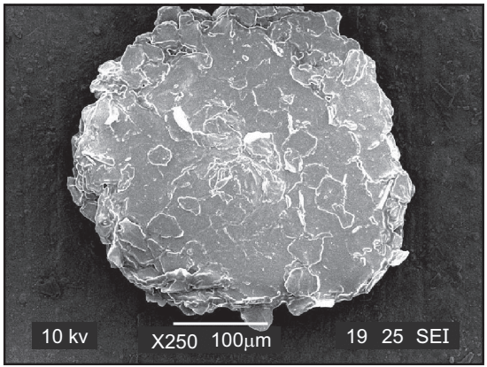 Scanning electron microscopic image of a dandruff flake 
