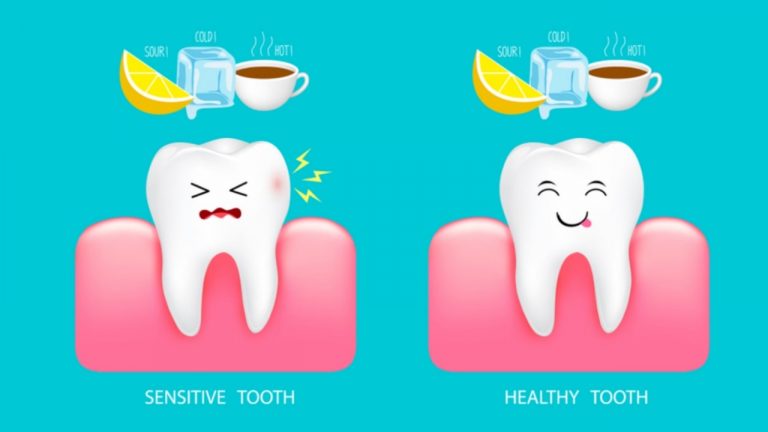 Tooth Sensitivity - Solution Parmacy