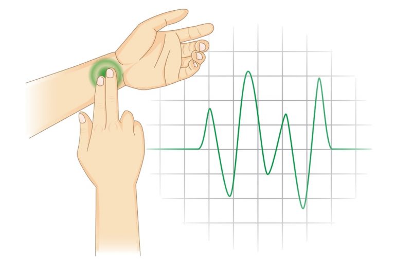 determination-of-pulse-rate-solution-parmacy