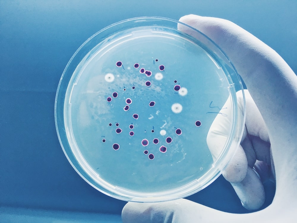 Biochemical Tests of Bacteria