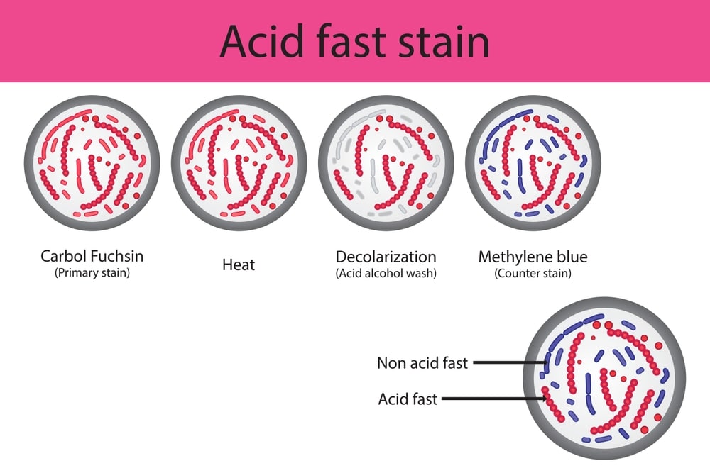 Principle and Procedure of Acid Fast Staining