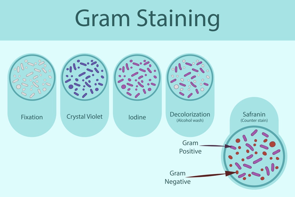 Principle and Procedure of Gram Staining