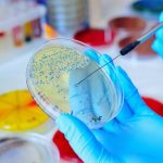 Scope and Importance of Microbiology