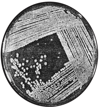 Isolated colonies of Streptomyces (Streak plate technique) 