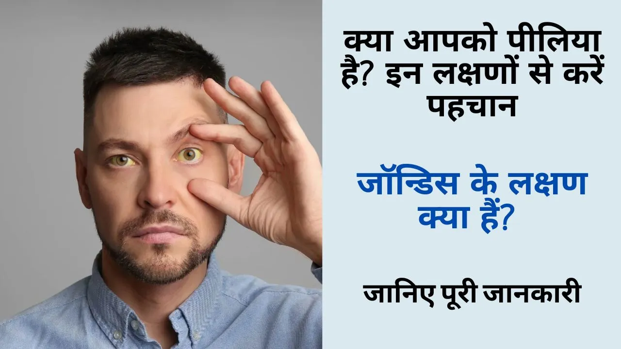 jaundice symptoms
